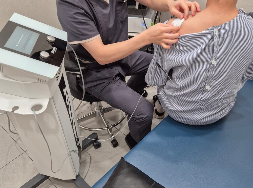 크라이오 치료
